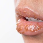Hvordan og hvad skal man bruge mod tørre læber? Hjemmelavede opskrifter
