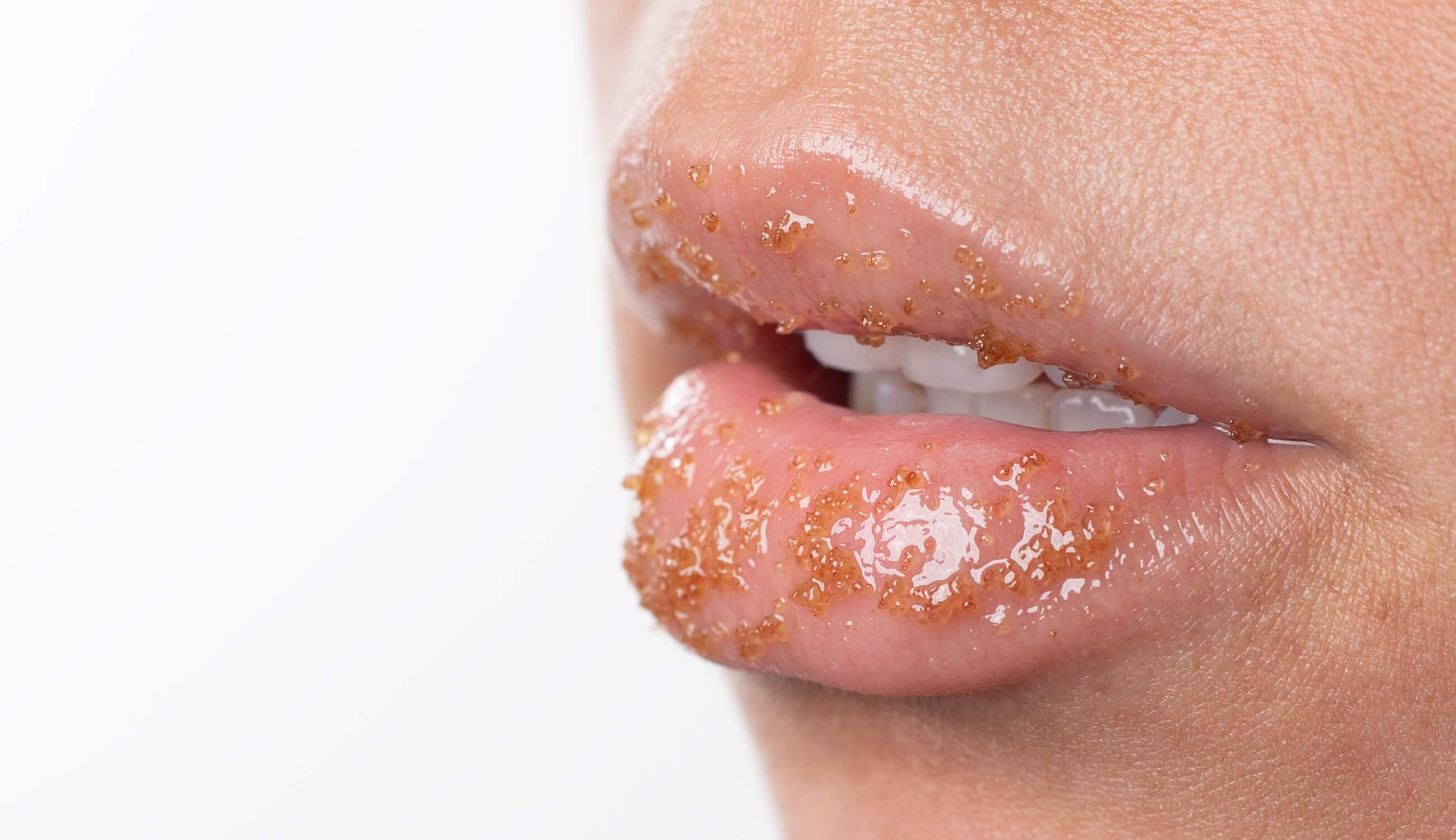 nedadgående Civic ønske Hvordan og hvad skal man bruge mod tørre læber? Hjemmelavede opskrifter